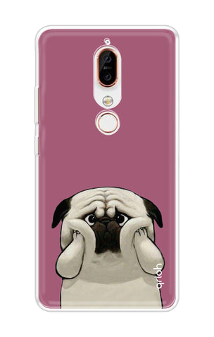 Chubby Dog Nokia X6 Back Cover